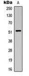 SMAD Family Member 3 antibody, orb304595, Biorbyt, Western Blot image 