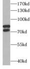 DEAD-Box Helicase 17 antibody, FNab02296, FineTest, Western Blot image 