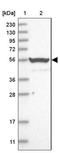 Methionyl-tRNA synthetase, mitochondrial antibody, NBP1-92106, Novus Biologicals, Western Blot image 