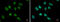 Myocyte Enhancer Factor 2B antibody, GTX119810, GeneTex, Immunofluorescence image 