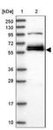 G Protein-Coupled Receptor 63 antibody, NBP1-82362, Novus Biologicals, Western Blot image 