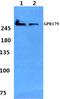 G Protein-Coupled Receptor 179 antibody, A10399, Boster Biological Technology, Western Blot image 