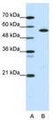Coronin 1A antibody, TA335668, Origene, Western Blot image 