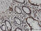 ASE-1 antibody, LS-C134032, Lifespan Biosciences, Immunohistochemistry frozen image 