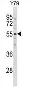 Zinc Finger Protein 620 antibody, AP54701PU-N, Origene, Western Blot image 