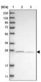 ATP Synthase Mitochondrial F1 Complex Assembly Factor 2 antibody, NBP1-88885, Novus Biologicals, Western Blot image 