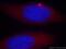 Threonyl-TRNA Synthetase antibody, 14773-1-AP, Proteintech Group, Immunofluorescence image 