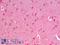 Zinc And Ring Finger 1 antibody, LS-C186637, Lifespan Biosciences, Immunohistochemistry paraffin image 
