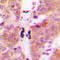 Kelch Like Family Member 29 antibody, LS-C356144, Lifespan Biosciences, Immunohistochemistry frozen image 