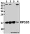 Ribosomal Protein S20 antibody, A06634-1, Boster Biological Technology, Western Blot image 