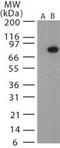 Protective antigen antibody, PA1-41081, Invitrogen Antibodies, Western Blot image 