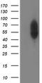 PHD Finger Protein 21B antibody, CF503245, Origene, Western Blot image 