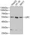 Hepatic triacylglycerol lipase antibody, GTX54314, GeneTex, Western Blot image 