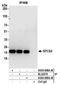 Signal Peptidase Complex Subunit 2 antibody, A305-609A-M, Bethyl Labs, Immunoprecipitation image 