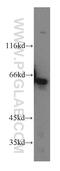 Kelch Like Family Member 18 antibody, 17229-1-AP, Proteintech Group, Western Blot image 