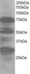 LIM Domain 7 antibody, MBS421148, MyBioSource, Western Blot image 