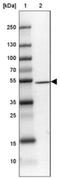 DENN Domain Containing 2D antibody, NBP2-30995, Novus Biologicals, Western Blot image 