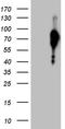 Forkhead Box O1 antibody, TA810676, Origene, Western Blot image 