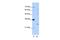 Exosome Component 4 antibody, PA5-41890, Invitrogen Antibodies, Western Blot image 