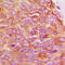 Junction Plakoglobin antibody, LS-C352407, Lifespan Biosciences, Immunohistochemistry paraffin image 