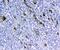 Stratifin antibody, A01127, Boster Biological Technology, Immunohistochemistry paraffin image 