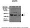 Cation-dependent mannose-6-phosphate receptor antibody, 29-879, ProSci, Enzyme Linked Immunosorbent Assay image 
