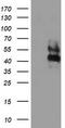 Leucine Rich Repeat Containing 25 antibody, TA504884S, Origene, Western Blot image 
