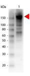 ABL Proto-Oncogene 1, Non-Receptor Tyrosine Kinase antibody, orb107131, Biorbyt, Western Blot image 