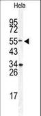 Downstream Neighbor Of SON antibody, LS-C167506, Lifespan Biosciences, Western Blot image 