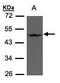 Zinc Finger DHHC-Type Containing 13 antibody, PA5-28398, Invitrogen Antibodies, Western Blot image 