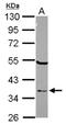 ElaC Ribonuclease Z 1 antibody, NBP2-16313, Novus Biologicals, Western Blot image 