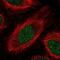 SP140 Nuclear Body Protein Like antibody, NBP2-49197, Novus Biologicals, Immunofluorescence image 