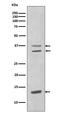 CEBPB antibody, M01100, Boster Biological Technology, Western Blot image 