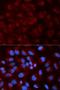 NADH:Ubiquinone Oxidoreductase Core Subunit S1 antibody, LS-C332192, Lifespan Biosciences, Immunofluorescence image 