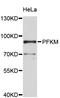 Phosphofructokinase, Muscle antibody, abx127005, Abbexa, Western Blot image 