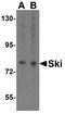Ski oncogene antibody, A01062, Boster Biological Technology, Western Blot image 