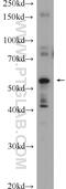 Abhydrolase Domain Containing 15 antibody, 22526-1-AP, Proteintech Group, Enzyme Linked Immunosorbent Assay image 