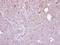 Steroid Sulfatase antibody, PA5-28259, Invitrogen Antibodies, Immunohistochemistry paraffin image 