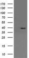 Mitogen-Activated Protein Kinase Kinase 3 antibody, TA505840, Origene, Western Blot image 