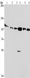 Protein Kinase D3 antibody, TA350764, Origene, Western Blot image 