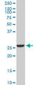 Glutathione S-transferase A2 antibody, LS-C197366, Lifespan Biosciences, Western Blot image 