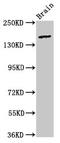 Adhesion G Protein-Coupled Receptor B2 antibody, LS-C671447, Lifespan Biosciences, Western Blot image 