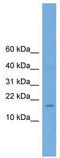 Basic Helix-Loop-Helix Family Member A9 antibody, TA329615, Origene, Western Blot image 