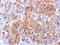 Melan-A antibody, AM50110PU-T, Origene, Immunohistochemistry paraffin image 