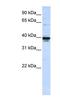 ETS Variant 3 Like antibody, NBP1-79214, Novus Biologicals, Western Blot image 