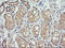 Cancer/Testis Antigen 1B antibody, LS-C174616, Lifespan Biosciences, Immunohistochemistry frozen image 