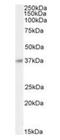 Basic Helix-Loop-Helix Family Member E22 antibody, orb389358, Biorbyt, Western Blot image 