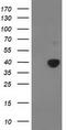 Pyruvate Dehydrogenase E1 Alpha 1 Subunit antibody, TA502696, Origene, Western Blot image 