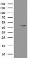 Phosphorylase Kinase Catalytic Subunit Gamma 2 antibody, TA800355BM, Origene, Western Blot image 