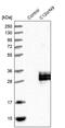 Chromosome 12 Open Reading Frame 49 antibody, PA5-55459, Invitrogen Antibodies, Western Blot image 